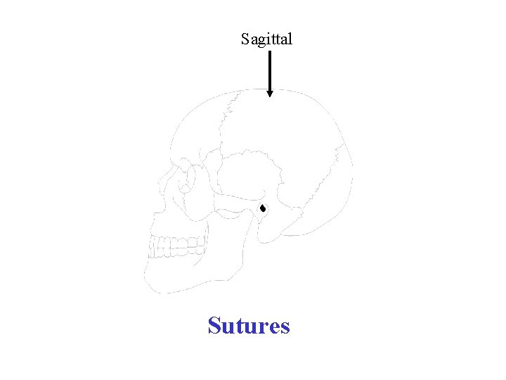 Sagittal Sutures 