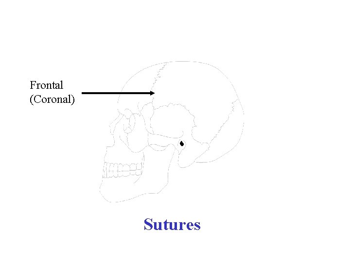 Frontal (Coronal) Sutures 