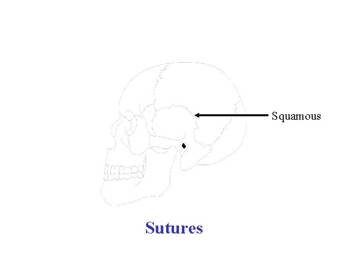 Squamous Sutures 