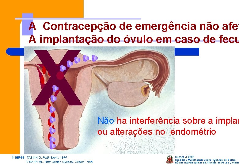 A Contracepção de emergência não afet A implantação do óvulo em caso de fecu