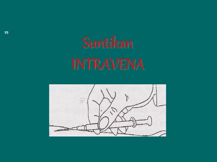 19 Suntikan INTRAVENA 