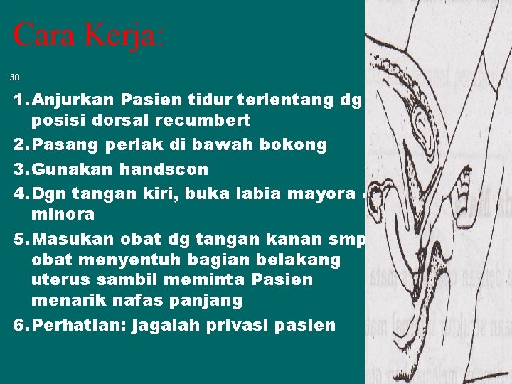 Cara Kerja: 30 1. Anjurkan Pasien tidur terlentang dg posisi dorsal recumbert 2. Pasang