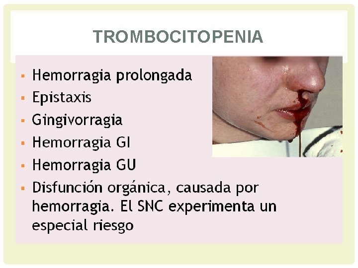 TROMBOCITOPENIA 