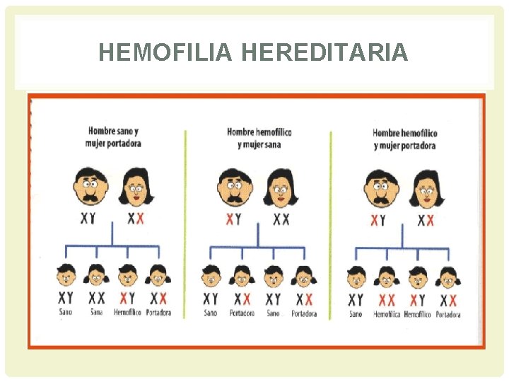 HEMOFILIA HEREDITARIA 