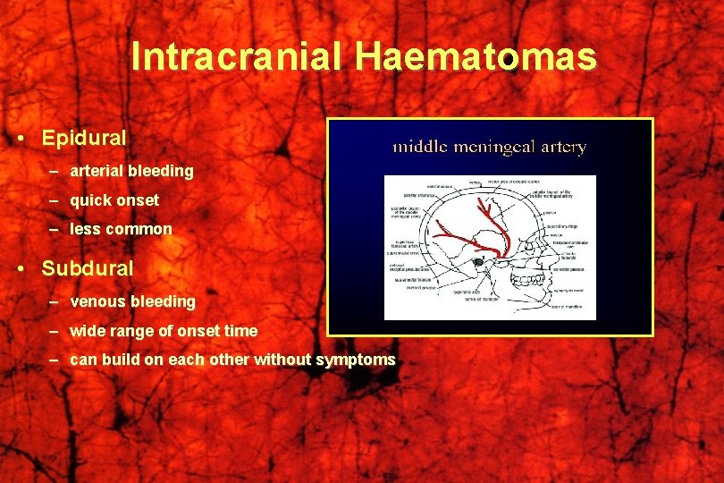 Intracranial Haematomas • Epidural – arterial bleeding – quick onset – less common •