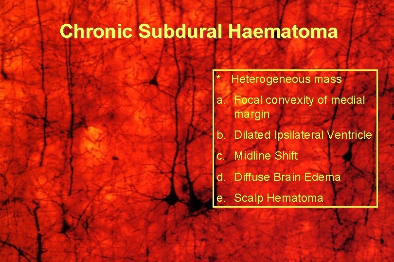 Chronic Subdural Haematoma * Heterogeneous mass a. Focal convexity of medial margin b. Dilated