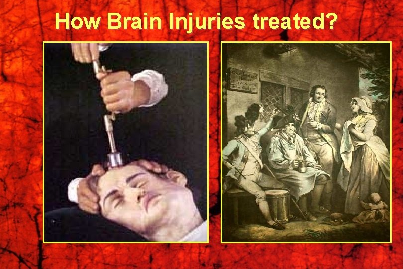 How Brain Injuries treated? 