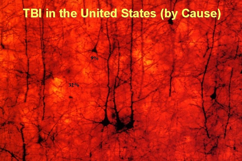 TBI in the United States (by Cause) 9% 32% 
