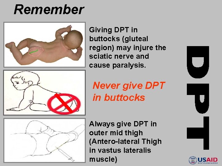 Remember Giving DPT in buttocks (gluteal region) may injure the sciatic nerve and cause