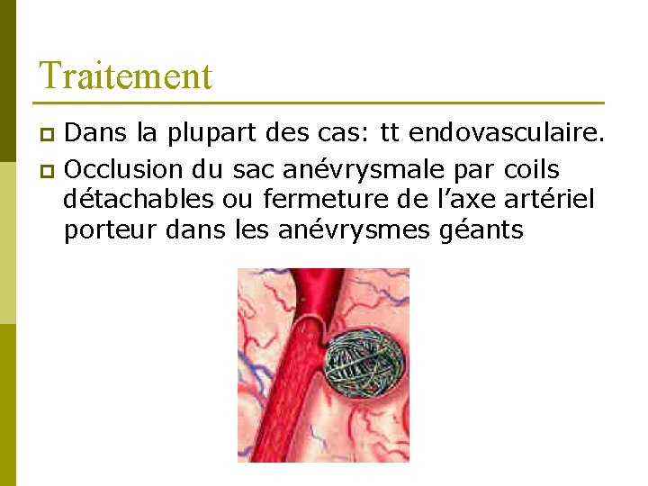 Traitement Dans la plupart des cas: tt endovasculaire. p Occlusion du sac anévrysmale par