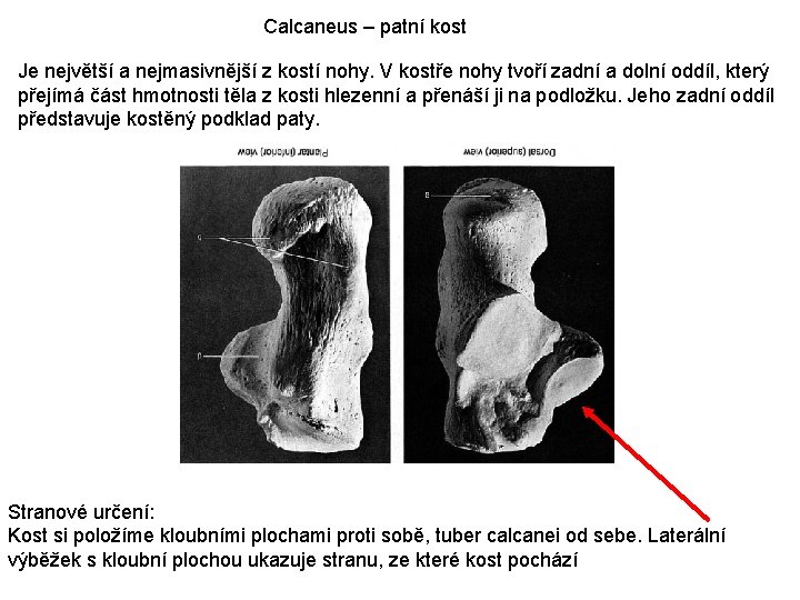 Calcaneus – patní kost Je největší a nejmasivnější z kostí nohy. V kostře nohy