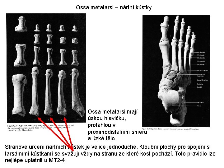 Ossa metatarsi – nártní kůstky Ossa metatarsi mají úzkou hlavičku, protáhlou v proximodistálním směru