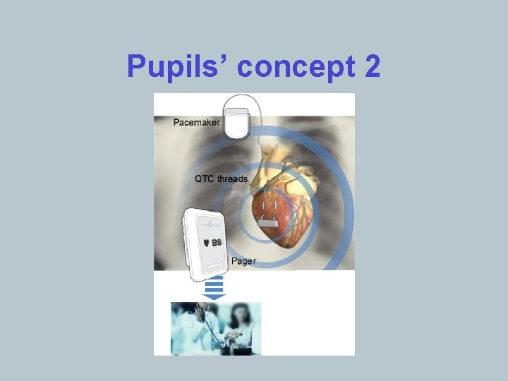 Pupils’ concept 2 
