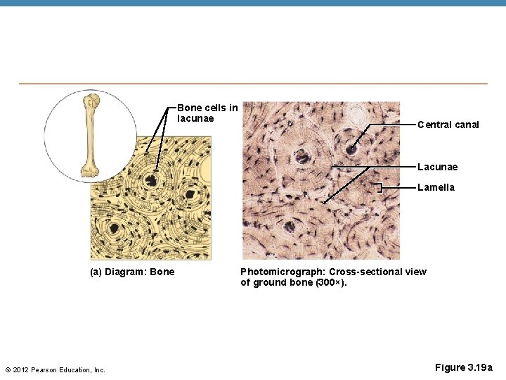 Bone cells in lacunae Central canal Lacunae Lamella (a) Diagram: Bone © 2012 Pearson