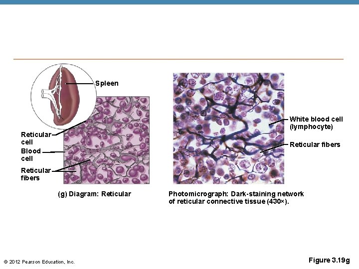 Spleen White blood cell (lymphocyte) Reticular cell Blood cell Reticular fibers (g) Diagram: Reticular