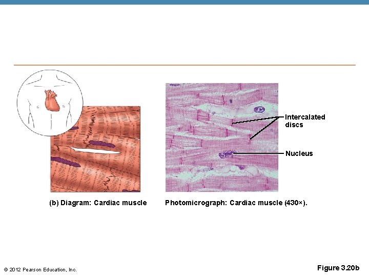 Intercalated discs Nucleus (b) Diagram: Cardiac muscle © 2012 Pearson Education, Inc. Photomicrograph: Cardiac