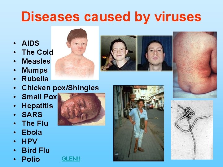 Diseases caused by viruses • • • • AIDS The Cold Measles Mumps Rubella