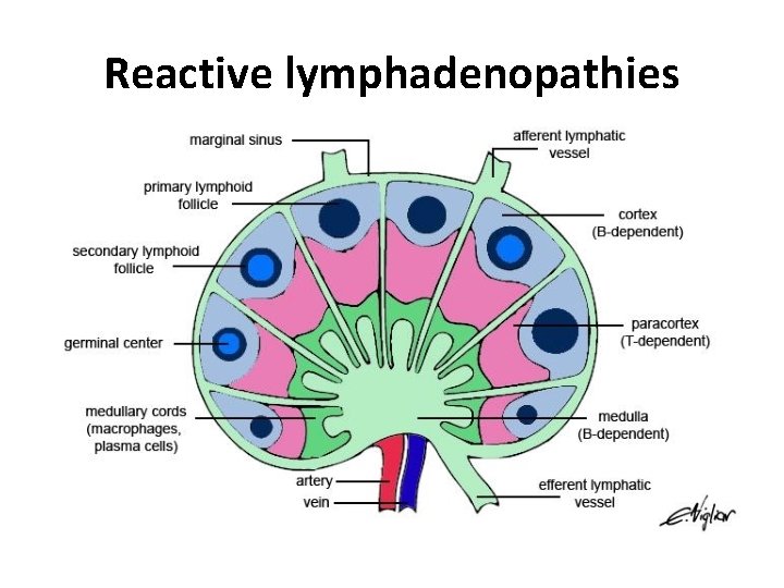 Reactive lymphadenopathies 