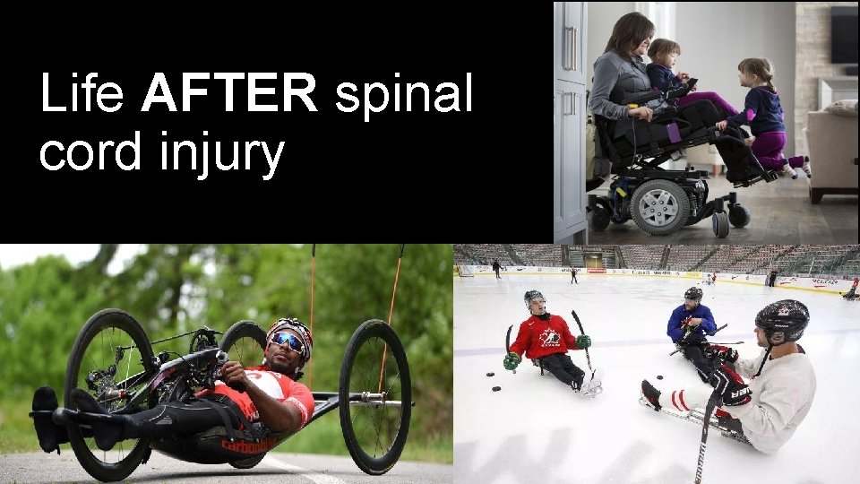 Life AFTER spinal cord injury 