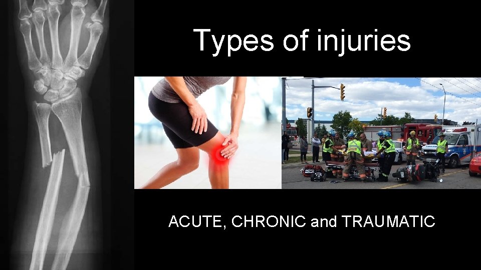 Types of injuries ACUTE, CHRONIC and TRAUMATIC 