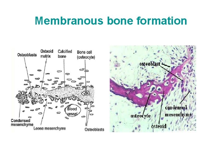 Membranous bone formation 