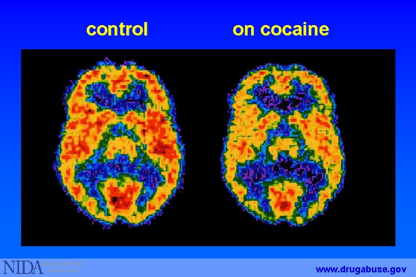 control on cocaine www. drugabuse. gov 