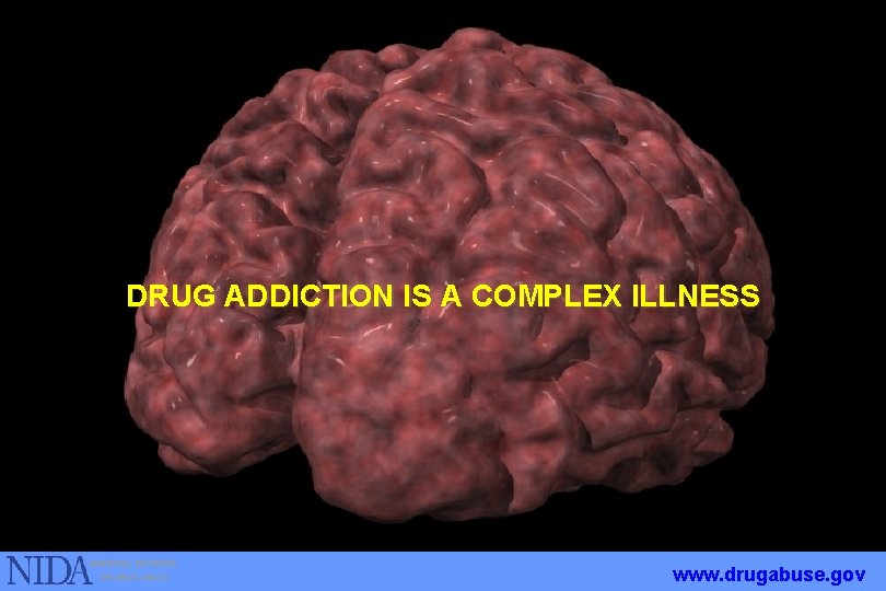 DRUG ADDICTION IS A COMPLEX ILLNESS www. drugabuse. gov 