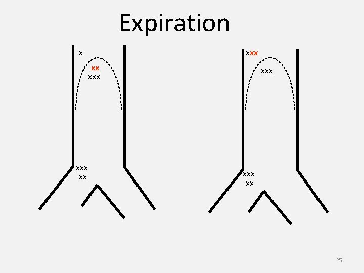 Expiration x xxx xx 25 