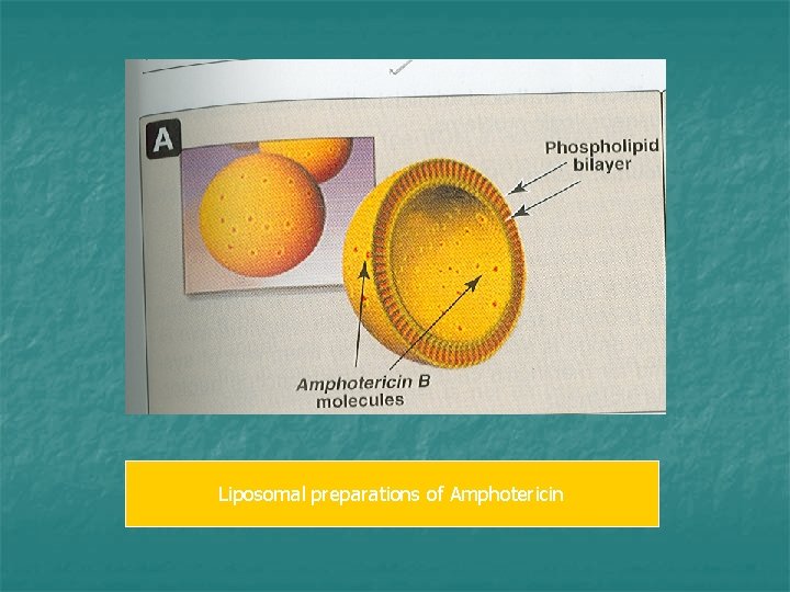 Liposomal preparations of Amphotericin 