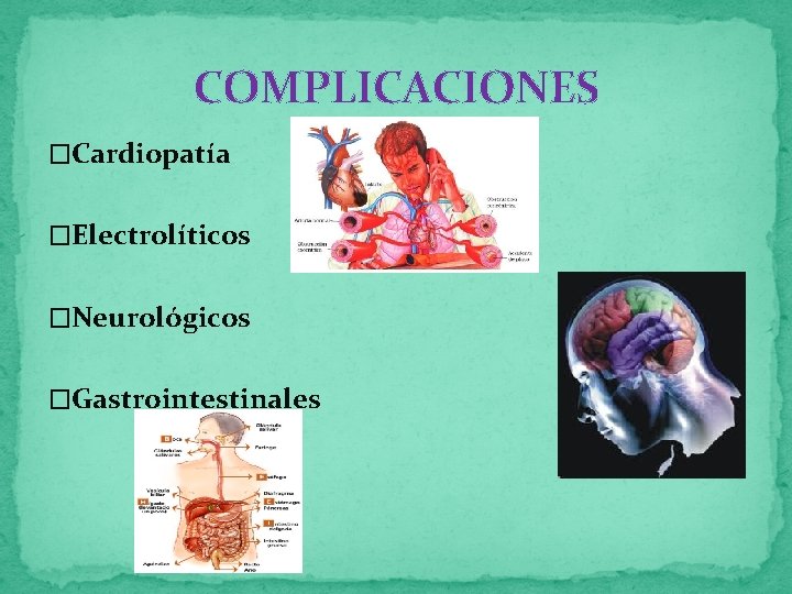 COMPLICACIONES �Cardiopatía �Electrolíticos �Neurológicos �Gastrointestinales 