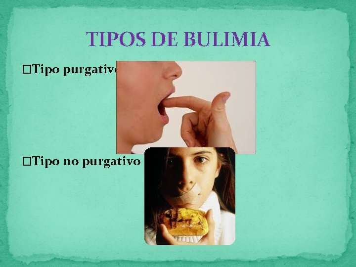 TIPOS DE BULIMIA �Tipo purgativo �Tipo no purgativo 