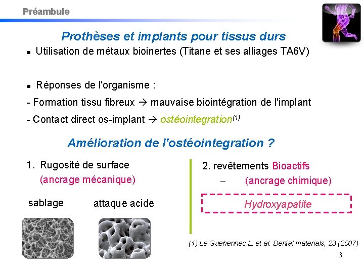 Préambule Prothèses et implants pour tissus durs Utilisation de métaux bioinertes (Titane et ses