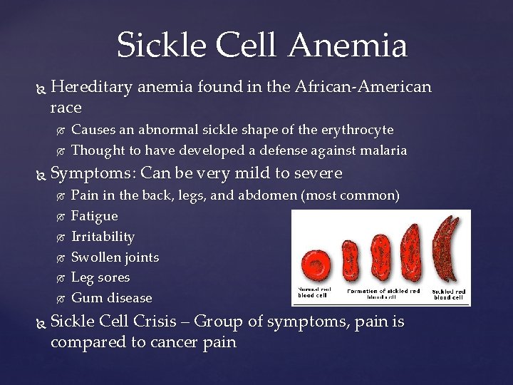 Sickle Cell Anemia Hereditary anemia found in the African-American race Symptoms: Can be very
