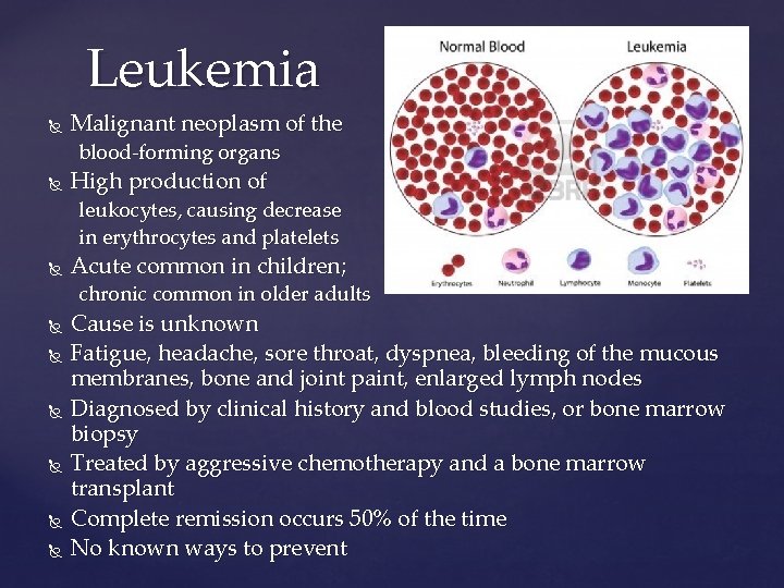 Leukemia Malignant neoplasm of the blood-forming organs High production of leukocytes, causing decrease in