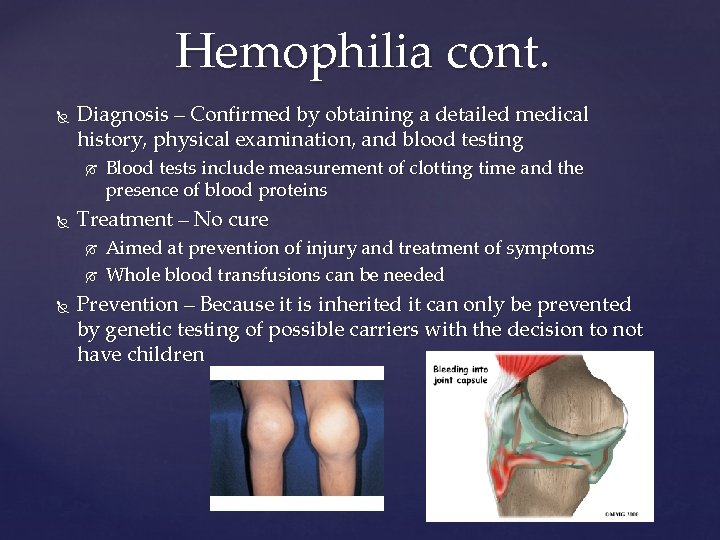 Hemophilia cont. Diagnosis – Confirmed by obtaining a detailed medical history, physical examination, and