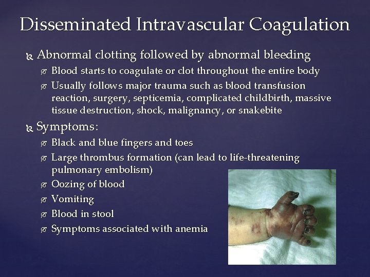 Disseminated Intravascular Coagulation Abnormal clotting followed by abnormal bleeding Blood starts to coagulate or
