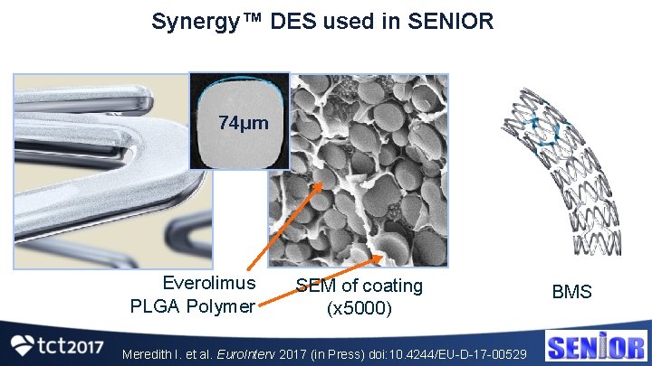 Synergy™ DES used in SENIOR 74μm Everolimus PLGA Polymer SEM of coating (x 5000)