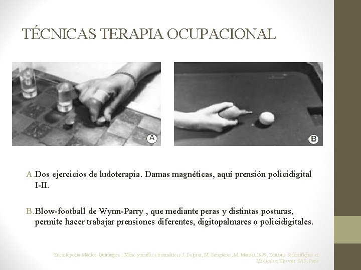 TÉCNICAS TERAPIA OCUPACIONAL A. Dos ejercicios de ludoterapia. Damas magnéticas, aquí prensión policidigital I-II.