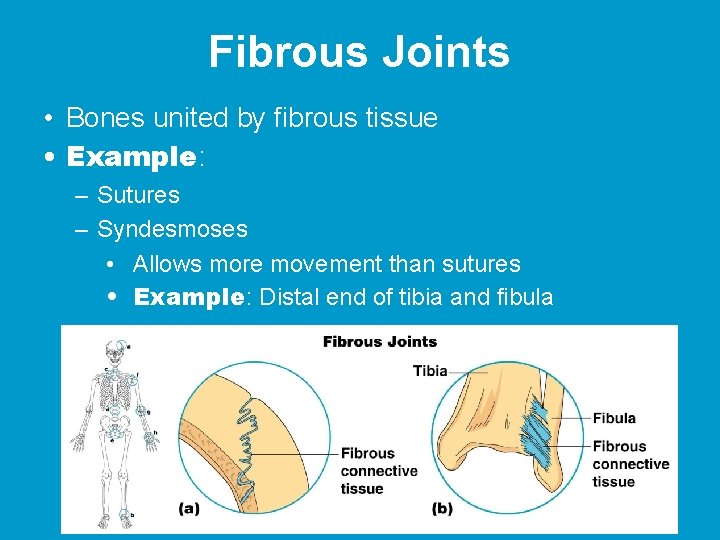 Fibrous Joints • Bones united by fibrous tissue • Example: – Sutures – Syndesmoses Fibrous Joints • Bones united by fibrous tissue • Example: – Sutures – Syndesmoses