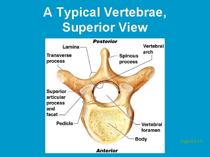 A Typical Vertebrae, Superior View Figure 5. 17  A Typical Vertebrae, Superior View Figure 5. 17