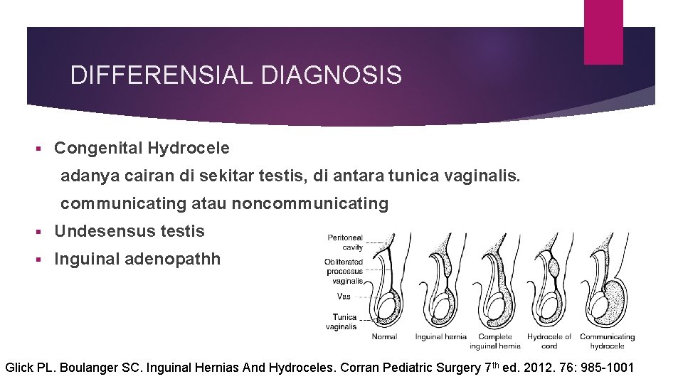 DIFFERENSIAL DIAGNOSIS § Congenital Hydrocele adanya cairan di sekitar testis, di antara tunica vaginalis.