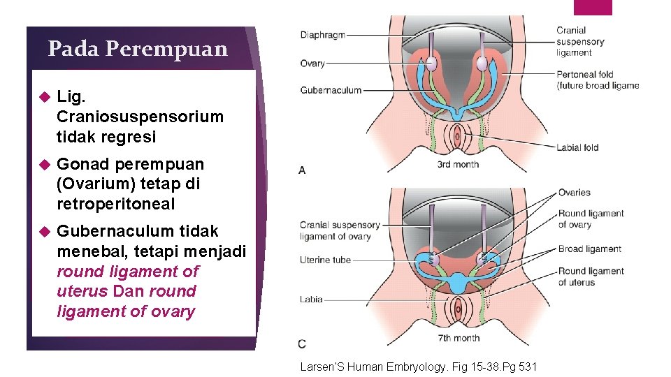 Pada Perempuan Lig. Craniosuspensorium tidak regresi Gonad perempuan (Ovarium) tetap di retroperitoneal Gubernaculum tidak