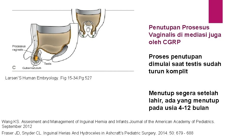 Penutupan Prosesus Vaginalis di mediasi juga oleh CGRP Proses penutupan dimulai saat testis sudah