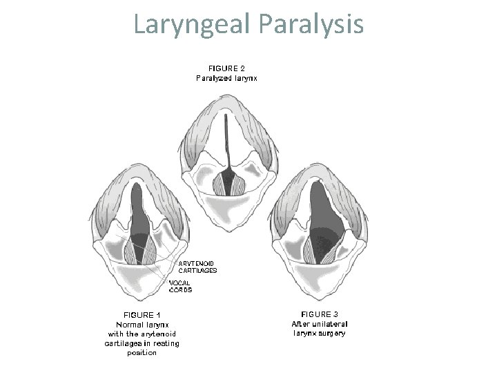 Laryngeal Paralysis 