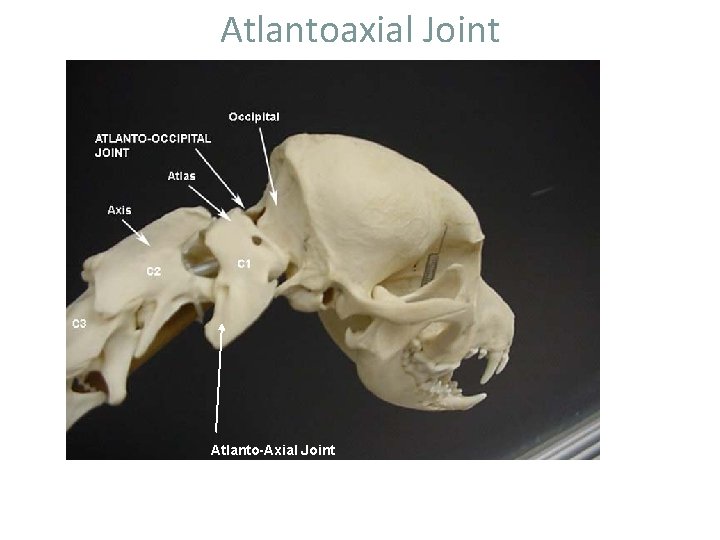 Atlantoaxial Joint Atlanto-Axial Joint 