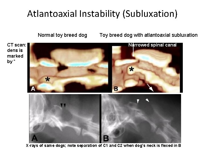 Atlantoaxial Instability (Subluxation) Normal toy breed dog CT scan: dens is marked by *