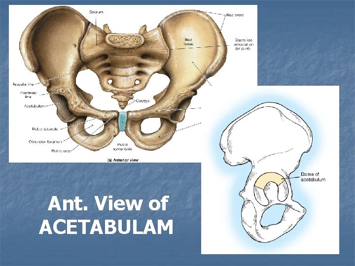 Ant. View of ACETABULAM 