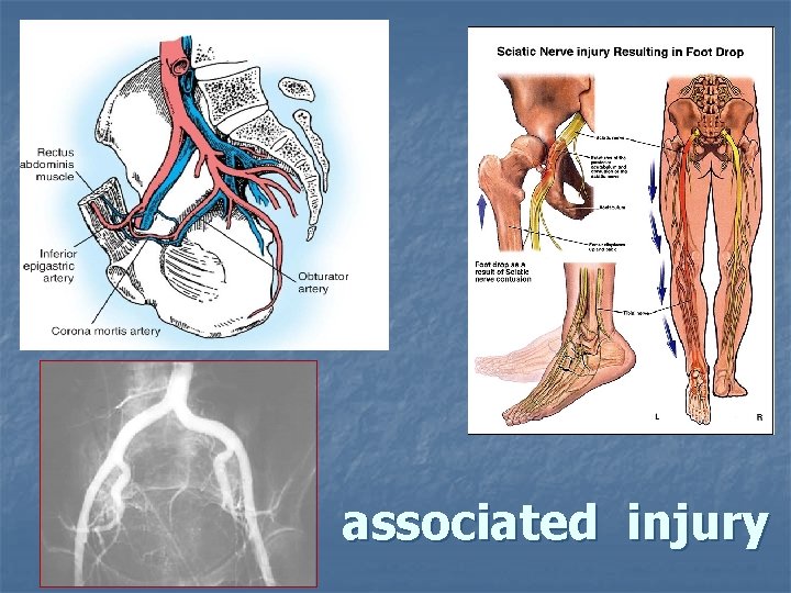 associated injury 