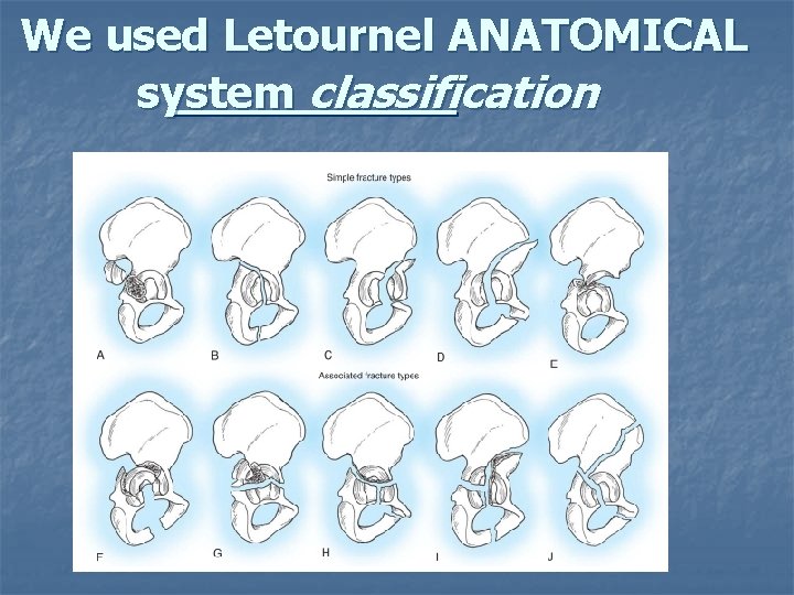We used Letournel ANATOMICAL system classification 