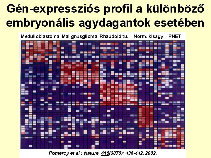 Gén-expressziós profil a különböző embryonális agydagantok esetében Medulloblastoma Malignusglioma Rhabdoid tu. Norm. kisagy Pomeroy